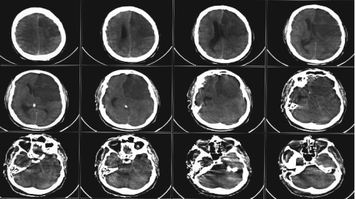 DICOM and NRRD File Viewer